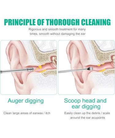 2sets Ear Wax Pickers Stainless Steel Earpick Wax Remover Curette Ear Pick Cleaner Ear Cleaner Spoon Care Ear Clean Tool - Buy Online on GoSupps.com