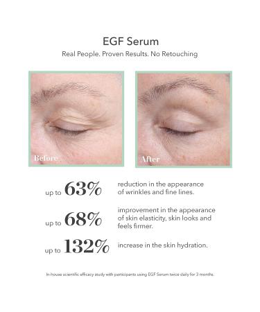 BIOEFFECT EGF Serum with Hyaluronic Acid and Barley Growth Factor - Rejuvenating Anti-Aging Facial Treatment for Wrinkles, Hydration, and Firming - Face & Neck Skincare - Oil-Free - Buy Online on GoSupps.com