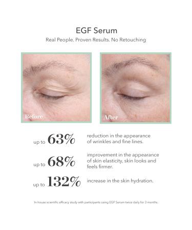 BIOEFFECT Classic Duo EGF Serum & Eye Serum Gift Set - Anti-Aging Moisturizing Skincare with Barley Growth Factor | International Shipping Available - Buy Online on GoSupps.com