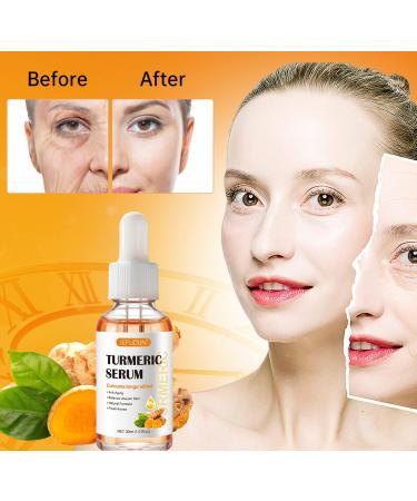 Turmeric Serum for Dark Spots Natural Turmeric Skin Brightening Serum Dark Spot Remover for face - Cleanses Skin Fights Acne Evens Tone Hair Growth (30ML) - Buy Online on GoSupps.com