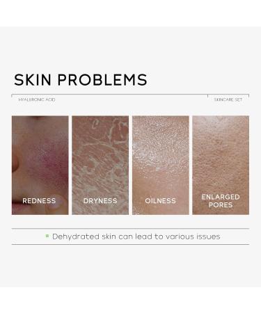 Skin Care Sets & Kits Hyaluronic Acid Travel Size Skincare Set With Hyaluronic Acid Serum Face Cream Eye Cream Skin Care Set For Teenage Girls Deep Hydrating Smooth Travel Size Kit - Buy Online on GoSupps.com