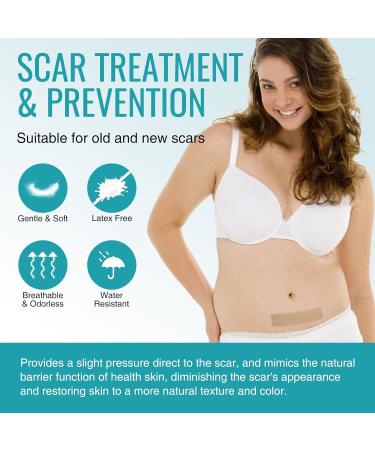 Scar Away Extra Strength Silicone Scar Sheets 4 Pack - Reusable Medical Grade Treatment for C-Section, Keloid, Surgery, Injury, and Burns - 5.7x1.57 inches - Buy Online on GoSupps.com