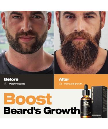 Waking Forest Beard Oil - Sandalwood Beard Growth Oil with Vitamin E Rosemary Castor & Argan - Ideal for Men's Grooming - Buy Online on GoSupps.com
