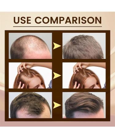 Lot de 2 s rums de croissance des cheveux 5 % d'huile de biotine am lior e soin du cuir chevelu arr te la chute et l'amincissement traitement de la croissance des cheveux pour tous les types de 2 pi ces. - Buy Online on GoSupps.com