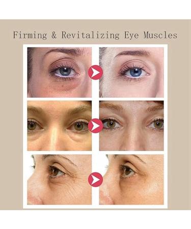 Korean Skincare Eye Cream Korean Eye Cream Eye Cream Korean Under Eye Serum Eye Serums Eye Serum Under Eye Cream for Dark Circles Under Eye Cream Dark Circles Under Eye Cream Mild Dry for Adults - Buy Online on GoSupps.com