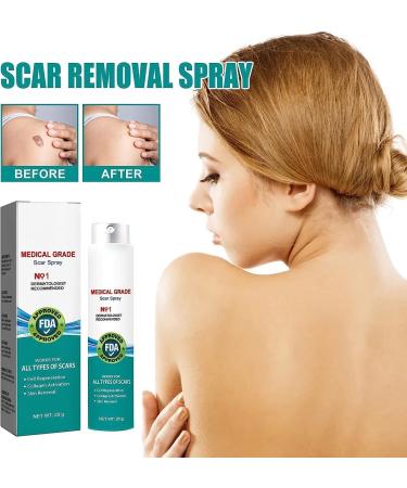 BLEDD Medical Grade Scar Spray - Advanced Scar Removal Treatment for Gentle Skin Care - 2pcs - Buy Online on GoSupps.com