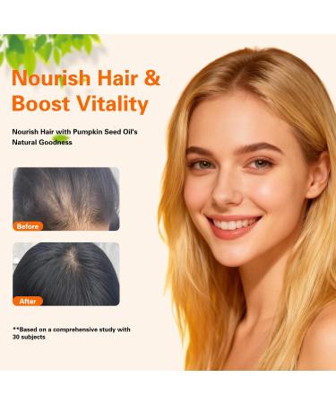 VITARENEW Pumpkin Seed Oil for Hair Growth with Saw Palmetto | 3000mg per Serving 300 Softgels | Supports Urinary & Prostate Health | Cold-Pressed Rich in Fatty Acids & Phytosterols Non-GMO - Buy Online on GoSupps.com