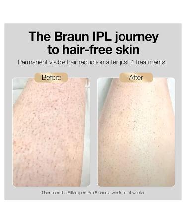Braun Silk Expert Pro 5 IPL Hair Removal System - Long-lasting, Head-to-toe Usage for Body & Face - Alternative to Salon Laser, with 3 Extra Caps - Buy Online on GoSupps.com
