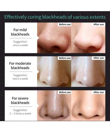 Blackhead Removal Peel Off Mask - Purifying Bamboo Charcoal Facial Mask for Deep Pore Cleansing & Skin Brightening - Suitable for All Skin Types - Buy Online on GoSupps.com