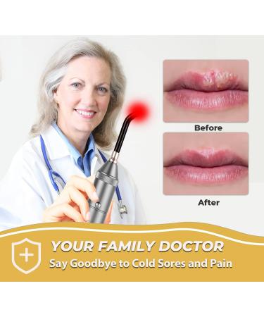 Red Light Therapy Device for Cold Sore Pain Relief - Oral & Facial Treatment - Buy Online on GoSupps.com