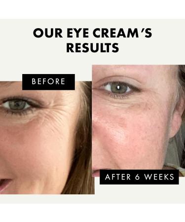 Organic Eye Cream for Dark Circles and Puffiness with Vitamin E - Anti-Aging Treatment for Men & Women - Buy Online on GoSupps.com