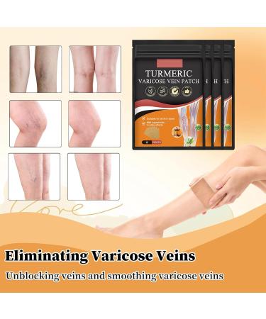 Patch Anti Varices 2x 48pcs patchs Varicose Veins Patch Varices Jambe Soulager Gonflement Varices Traitement Jambe pour Les Jambes limine Les Varices et Les Varicosit s - Buy Online on GoSupps.com