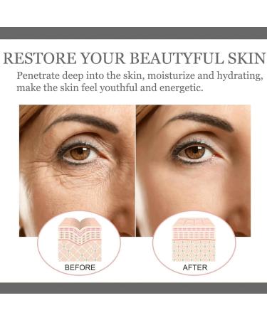 Retinol 0.5% in Squalane Serum Anti-Aging Serum Retinol Serum for Face Hyaluronic Acid Serum for Activate Skin Face Serum for Women Anti-Wrinkle Serum Smooth Skin Hyaluronic Acid Moisturiser - Buy Online on GoSupps.com