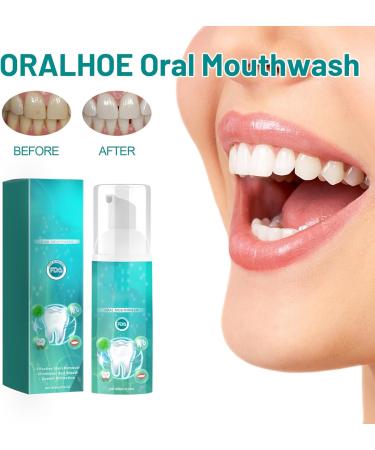 Furzero Smartsmile Oral Mouthwash - Teeth Whitening & Fresh Breath Care (3PCs) | Awzlove Total Care for Tooth & Gum Health - Buy Online on GoSupps.com
