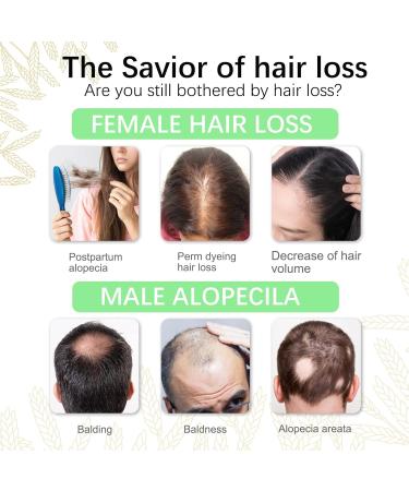 Rice Water for Hair Growth | Rosemary Oil Serum & Spray | Biotin & Caffeine Hair Loss Treatment for Women & Men - Buy Online on GoSupps.com