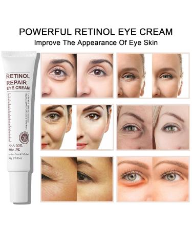 Buy Retinol Eye Cream with AHA & BHA - Dark Circles & Puffy Eyes Treatment | Anti-Aging Instant Eye Tightener for Men & Women - International Shipping - Buy Online on GoSupps.com