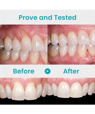 Lovild's Gums Therapy Gel | Effective Gum Care for Healthier Smiles | International Shipping Available - Buy Online on GoSupps.com