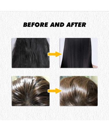 gifyym Rosemary Clarifying Hair Scrub for Buildup Removal Hair with silicone massager for women Promote for prone greasy and dry itchy 100g - Buy Online on GoSupps.com