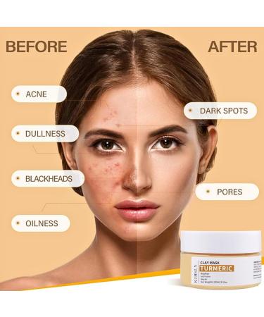 Turmeric Face Clay Mask with Kaolin Clay Vitamin C Clay Mask Deep Cleansing Pore Mask Clay Face Mask Mud Mask for Radiant Skin Oil Balance Face Masks Skincare for Blackhead Blemish & Acne - Buy Online on GoSupps.com