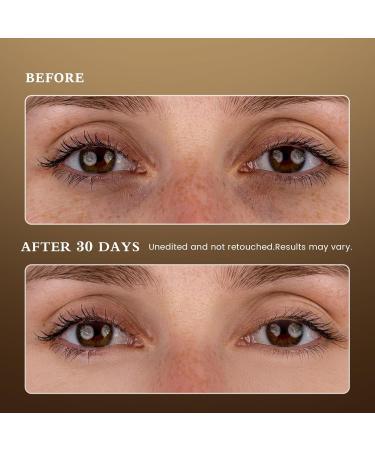 Puffy Eyes Smoothing Under Eye Patches - Caffeine Eye Masks for Wrinkles Dark Circles & Undereye Bags - Brightening Vegan Skincare Treatment for Men & Women - Buy Online on GoSupps.com