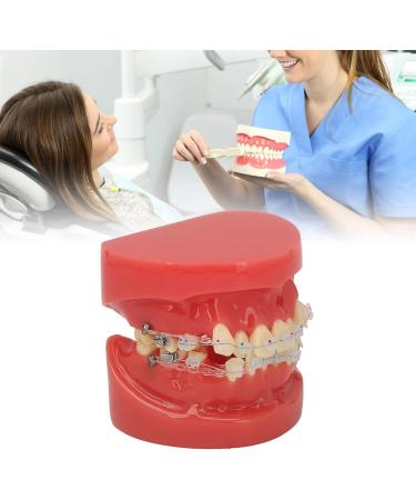 Orthodontic Model 24 Teeth with Metal Wire Case - Ideal for Dental Hospitals | International Shipping Available - Buy Online on GoSupps.com