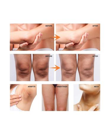 ASA VEA Dark Spot Corrector Cream with Collagen - For Underarms, Legs, Knees, Bikini Line - 60g - Buy Online on GoSupps.com