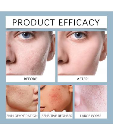 Facial Toner For Skin Care - Long-Lasting Hydration Brightens Skin Easy Absorption No Greasy Residue(1PCS) - Buy Online on GoSupps.com