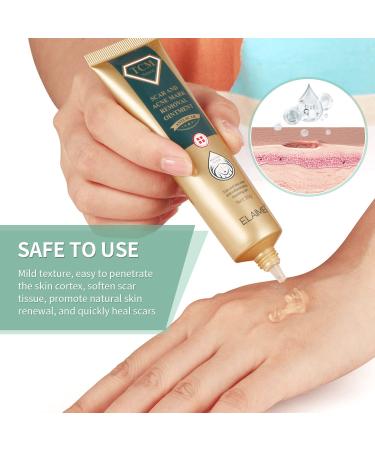 AiniFan Silicone Scar Sheets 60-Roll and Scar Gel Cream 2-in-1 Set - 1.5M + 1.06oz - Buy Online on GoSupps.com