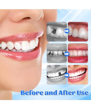 PGonline Temporary Tooth 30g Tooth Repair Kit Dental Plasters Fixed Dental Beads Temporary Teeth False Tooth for Missing Broken Teeth Dental Filling Material - Buy Online on GoSupps.com