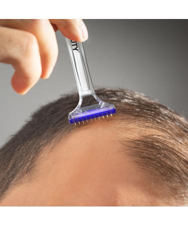 KOI BEAUTY Derma Stamp 1mm for Hair and Beard Growth for Women and Men Derma Roller with 80 Titanium Needles Professional Microneedling Pen Dermastamp for Face Body and Scalp Skin Care at Home - Buy Online on GoSupps.com