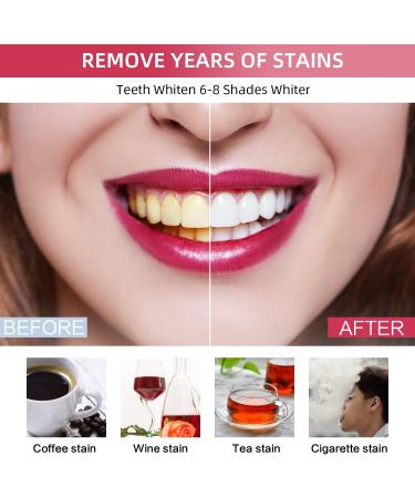 PDOO Teeth Whitening Kit for Sensitive Teeth - Fast At-Home Results with LED Light and Carbamide Peroxide Gel - Buy Online on GoSupps.com