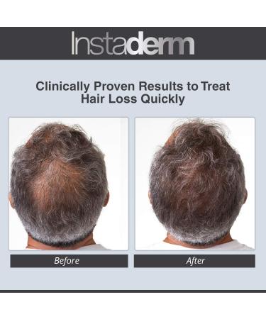 Hair Stimulating Growth Serum - Extra Strength DHT Blocker for Thicker Fuller Hair | Follicle Restoration for Men & Women - Shop Now - Buy Online on GoSupps.com