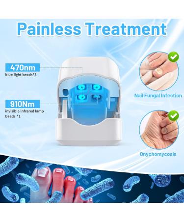 Best Nail Fungus Treatment Device | Rechargeable Cold Laser Therapy for Fingers & Toenails - Buy Online on GoSupps.com