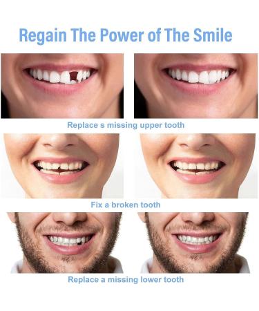 OTCPP Temporary Tooth Repair Kit - 50g Filling Beads & 60pcs Thermal Beads Replacement - Buy Online on GoSupps.com
