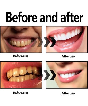 Cleopatra Natural Teeth Whitening Powder - Activated Coconut Charcoal for Deep Cleaning - 2 Bottles of Effective Teeth Whitener - Buy Online on GoSupps.com