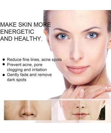 Dark Spot Corrector & Age Spot Remover for Face & Body - Freckle Remover Cream - Hyperpigmentation Treatment with Nicotinamide Vitamin E Glycerol - Spot Cream for Uneven Skin Tone - Buy Online on GoSupps.com
