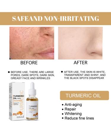 2 Pack Turmeric Dark Spot Corrector Serum - Natural Brightening and Moisturizing Face Repair Serum with Turmeric Oil (30ml) - Buy Online on GoSupps.com
