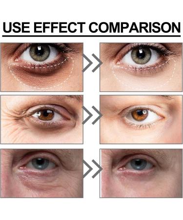 Anti Wrinkles Eye Serum Under Eye Serum For Dark Circle Eye Cream Anti Aging Nicotinamide Eye Creams For Dark Circle Hydrating Under Eye Cream - Buy Online on GoSupps.com