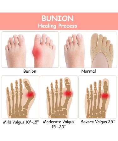 Shop Aster 5 Pairs Orthopedic Toe Compression Socks for Women - No Show Bunion Relief & Breathable Five Finger Liner Socks - Buy Online on GoSupps.com