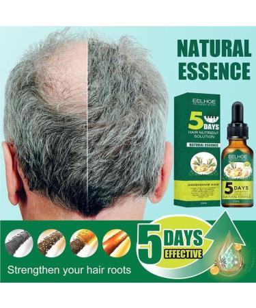dijiusidy Ginger Hair Growth Oil Prevent Baldness Good-absorption Fast Growing 30MLSerum Nourish Tools Female - Buy Online on GoSupps.com