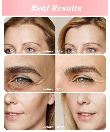 Retinol Eye Stick - Anti-Aging Under Eye Cream for Fine Lines & Dark Circles | International Shipping Available - Buy Online on GoSupps.com