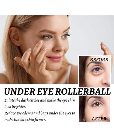 Huile de ricin bille rouleau pour les yeux huile de ricin et rouleau d'encens pour les yeux s rum rouleau pour les yeux soulage la fatigue oculaire poches sous les yeux anti-rides et r duit - Buy Online on GoSupps.com