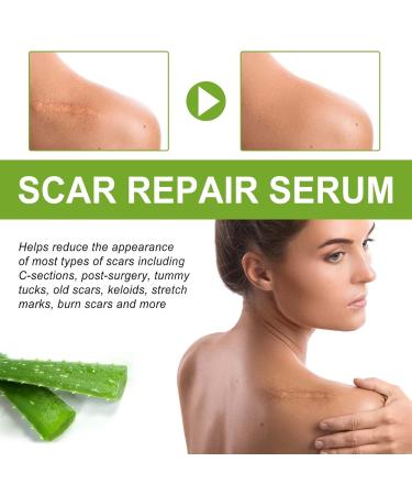 Advanced Scar Repair Serum - Intensive Overnight Cream for Face & Body - Nature Scar Treatment Gel - Pregnancy Safe - Smoothing Skin Care Essence (Green) - Buy Online on GoSupps.com