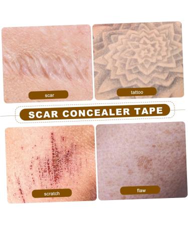 minkissy Lot De 2 Bandes Adh sives En Silicone Pour Dissimuler Les Cicatrices Autocollantes Sans Danger Pour La Peau. - Buy Online on GoSupps.com