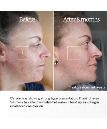 Filab of Switzerland Ltd Uneven Skin Tone Intelligent facial care for the treatment of hyperpigmentation and age spots - Buy Online on GoSupps.com