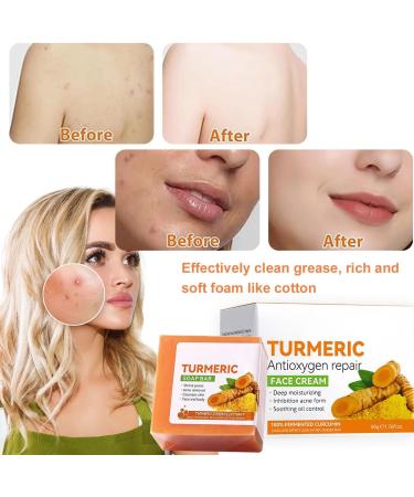 Turmeric Soap Turmeric Brightening Soap Kojic Acid Soap Turmeric Soap Bar Turmeric Soap Bar for Deep Cleansing Women's Men's Soap Bar for Face & Body with A Foaming Net (100g) - Buy Online on GoSupps.com