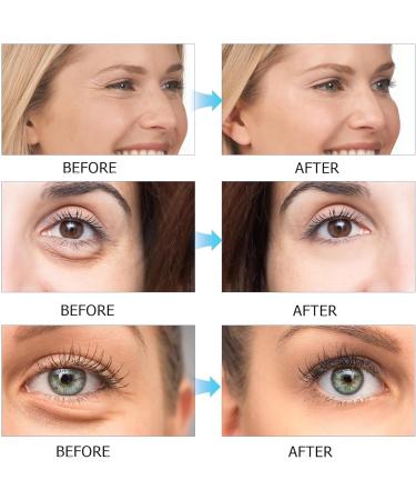 Renew Ritual Serum Renew Serum Say Goodbye To Dark Spots Intense Renewal Serum Hydrating Facial Serum Promote Collagen Production Transform Your Skin Naturally (60ML 1PCS) 1PCS 60 ml (Pack of 1) - Buy Online on GoSupps.com