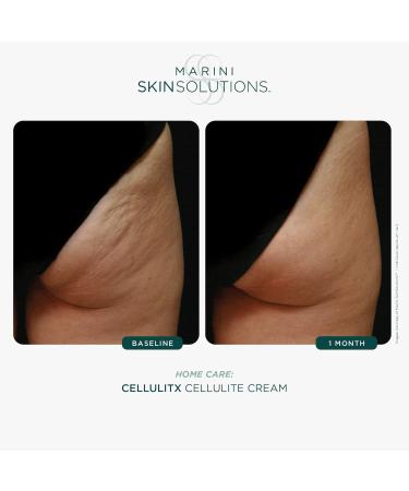Marini SkinSolutions CELLULITX - Buy Online on GoSupps.com