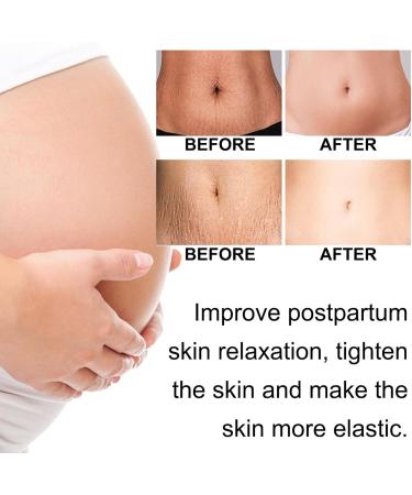 Stretch Mark Cream Pregnancy Stretch Mark Remover Moisturizing Maternity Cream Skin Tightening Cream Maternity Skin Care Increase Skin Elasticity Increase Skin Elasticity 100g - Buy Online on GoSupps.com