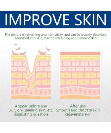 Yeast Ointment for All Skin Types - 2PCS Moisturizing Cream for Grater & Dry Skin Repair | Gentle Skin Care for Men & Women - Buy Online on GoSupps.com